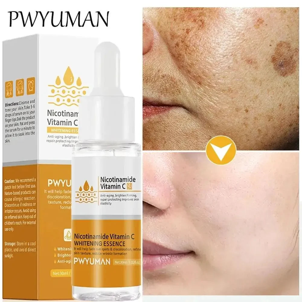 Powerful Dark Spots Remover Whitening Serum Face Freckle Melanin Correcting Anti Pigmentation Brighten Skin Beauty Care Products
