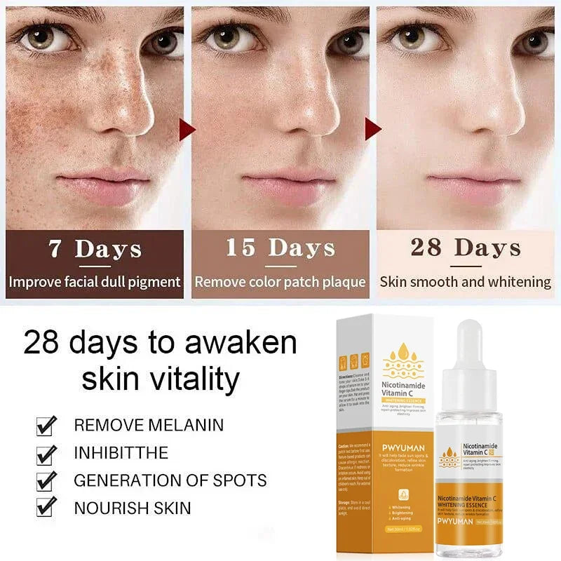 Powerful Dark Spots Remover Whitening Serum Face Freckle Melanin Correcting Anti Pigmentation Brighten Skin Beauty Care Products