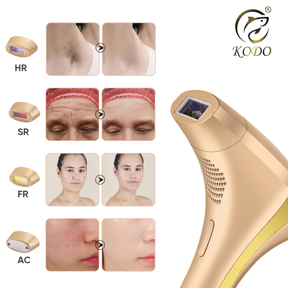 KODO 2026 High-end customization ice Laser Hair removal Laser Epilator Permanent IPL Painless Photoepilator 4 in 1 face and body
